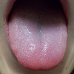 Tongue 17