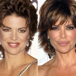 Lisa-Rinna-plastic-surgery