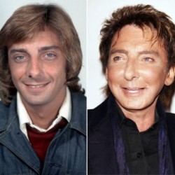 barry-manilow-addicted-to-plastic-surgery