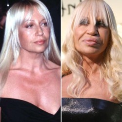 donatella-versace-plastic-surgery-by-50