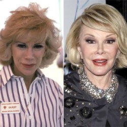 joan-rivers-addicted-to-plastic-surgery