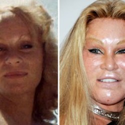 jocelyn-wildenstein-plastic-surgery-before-after