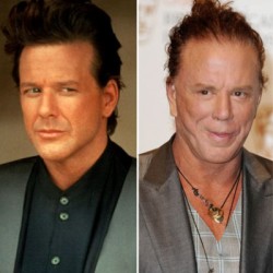 mickey-rourke-plastic-surgery-before-after