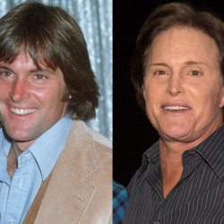 rs_1024x759-130912145605-1024-bruce-jenner-plastic-surgery.ls_.91213_copy_2